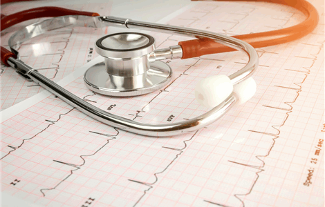 Home GP Doctor for palpitations in Sotogrande