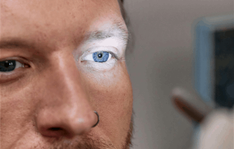 Diagnóstico de degeneración macular en Marbella